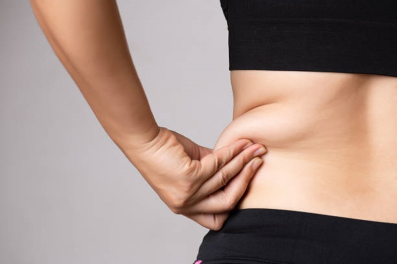 liposuction